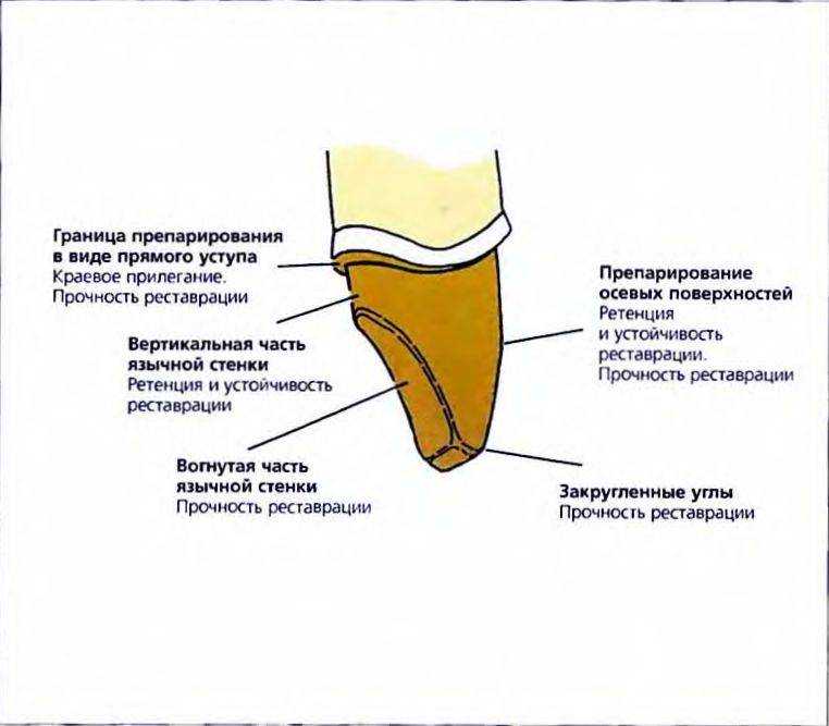 Препарирование зубов под фарфоровые коронки Препарирование зубов под фарфоровые коронки